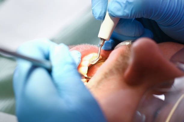 Best Emergency Dental Filling Replacement  in Rockport, TX