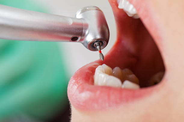 Best Tooth Infection Emergency Dentist  in Rockport, TX